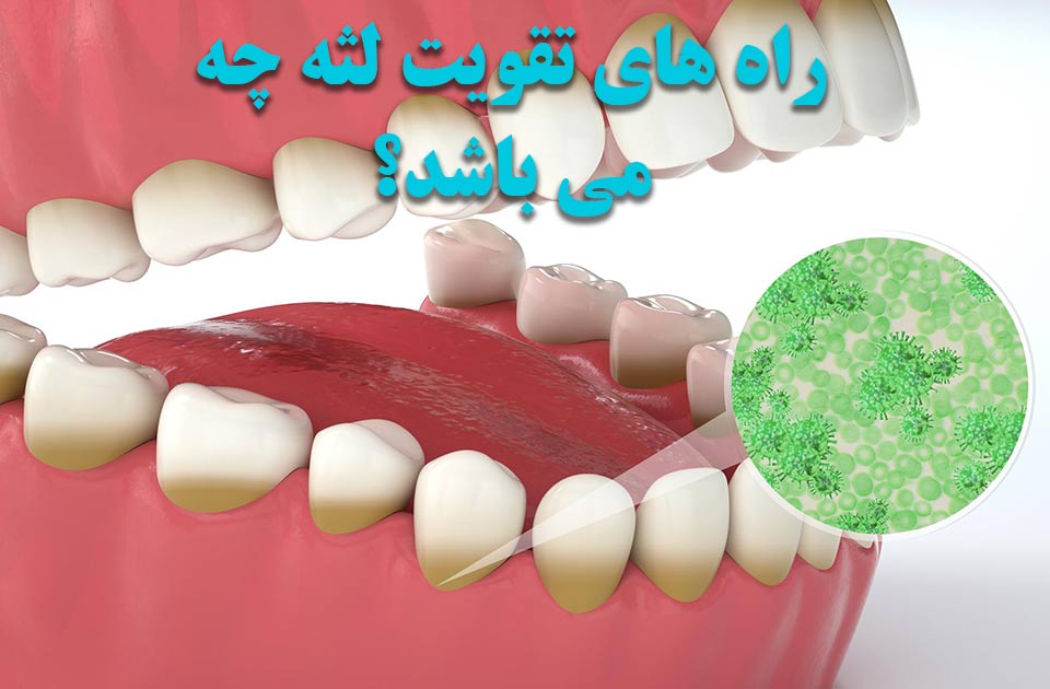 راه های تقویت لثه چه می باشد ؟
