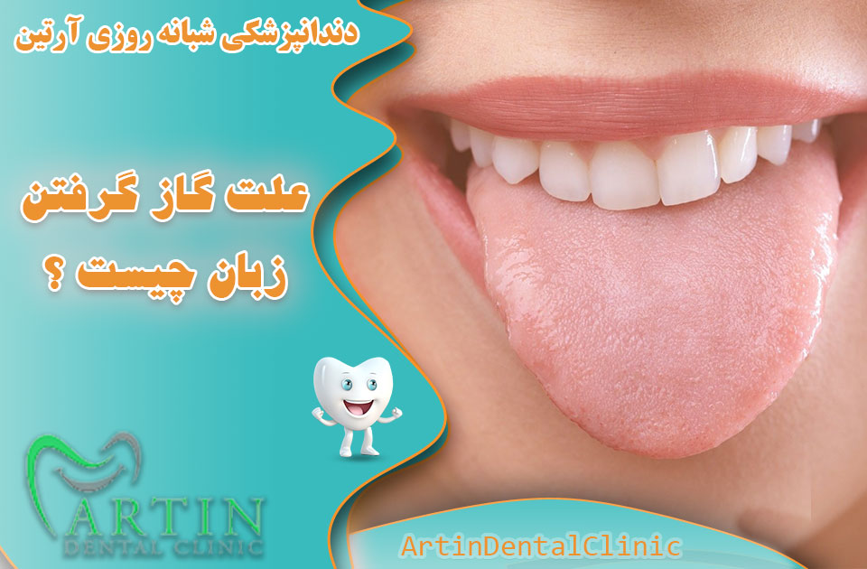 علت گاز گرفتن زبان چیست ؟