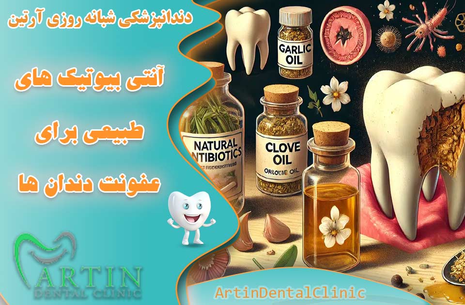 آنتی بیوتیک های طبیعی برای عفونت دندان ها ( تاثیرگذاری 100 درصدی )