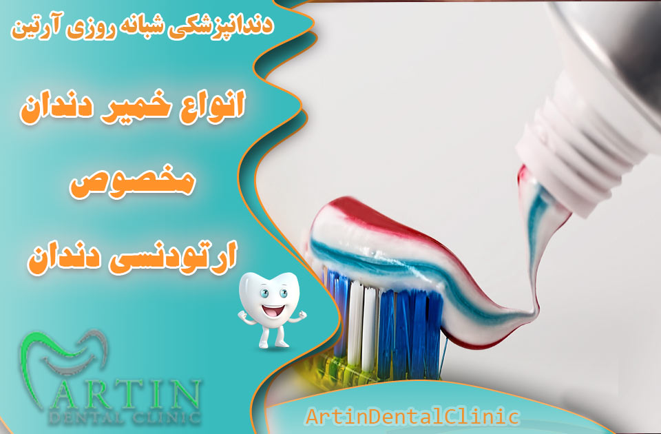 انواع خمیر دندان مخصوص ارتودنسی دندان