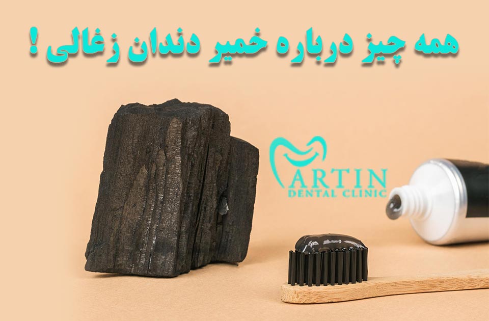 همه چیز درباره خمیر دندان زغالی !