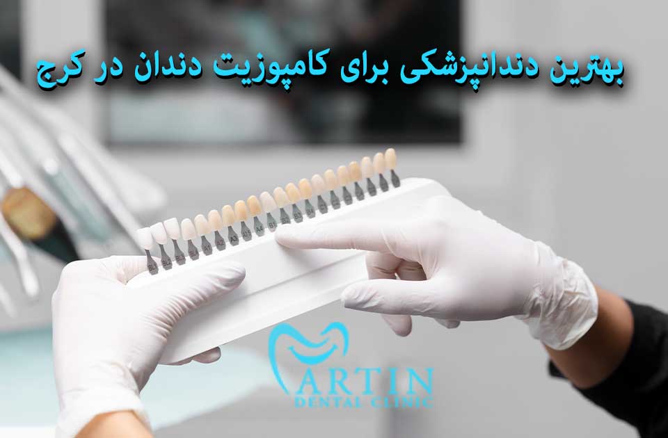 بهترین دندانپزشکی برای کامپوزیت دندان در کرج