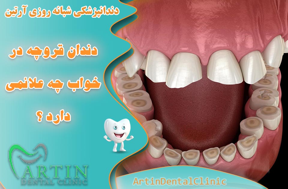 دندان قروچه در خواب چه علائمی دارد ؟